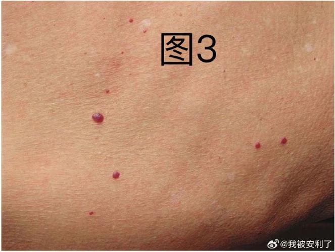红点视频内容