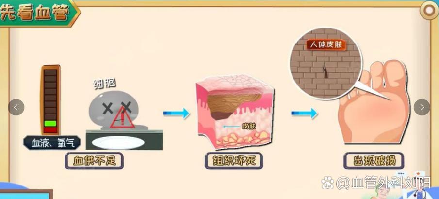 60至70岁糖化血糖标准