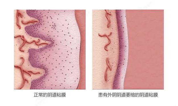 手机照片设为私密后 在哪里能找到