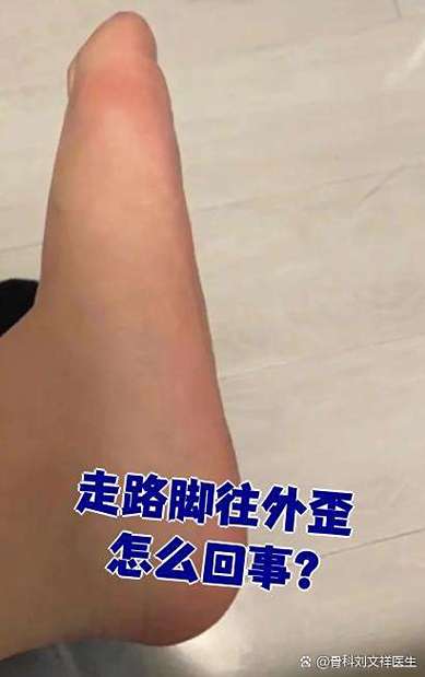 走路向右偏怎么回事图标