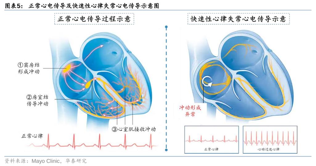 心率过快的原因及治疗图标