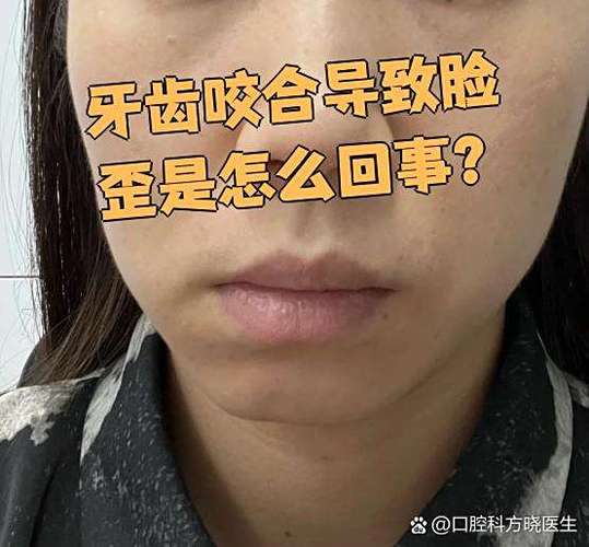 牙齿歪了导致嘴巴歪了缩略图