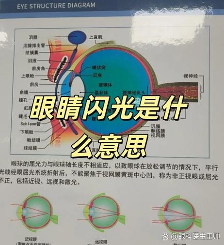 眼睛闪光是什么原因造成的缩略图