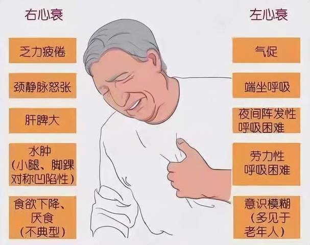 心衰脸发黑怎么回事缩略图