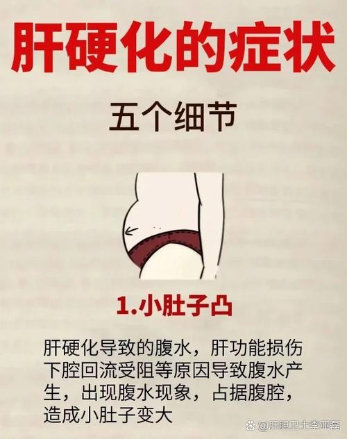 女人得了肝病最初表现