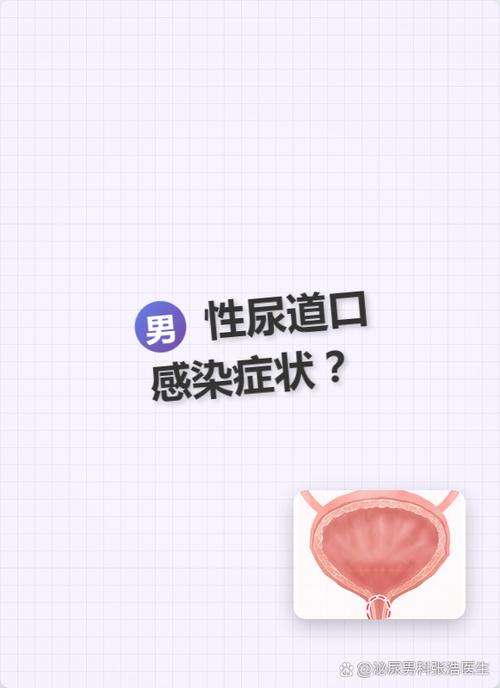 尿道口胀痛老想排尿图标
