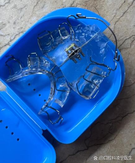 自制牙齿矫正器缩略图