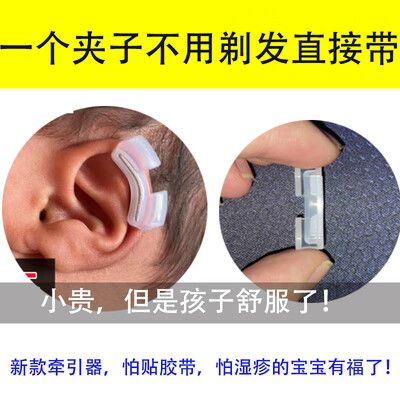 小耳畸形国家免费政策