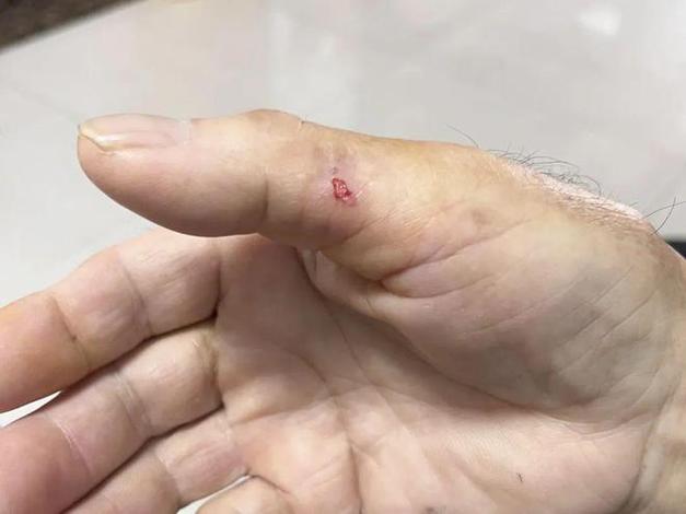 仓鼠咬到手没破皮图标