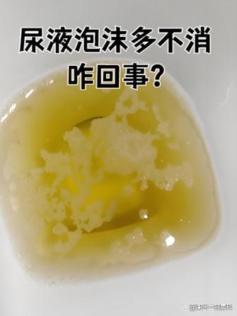 榨汁为什么那么多泡沫图标