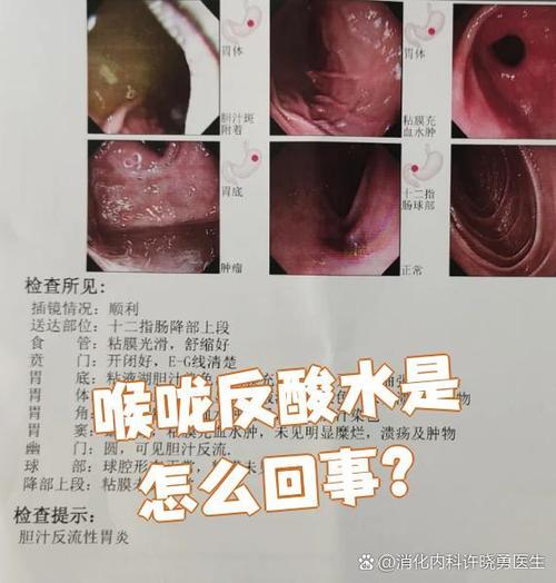 嘴巴里反清水是怎么了图标