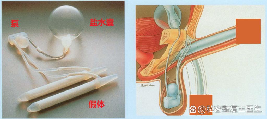 男性三件套手术的价格图标