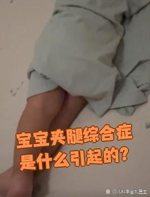 宝宝夹腿综合症是什么症状