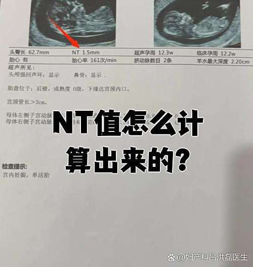 试纸能试出来男孩女孩吗游戏截图