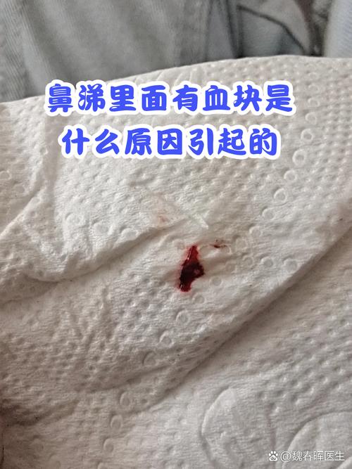 流鼻血拉出一长条血块图标