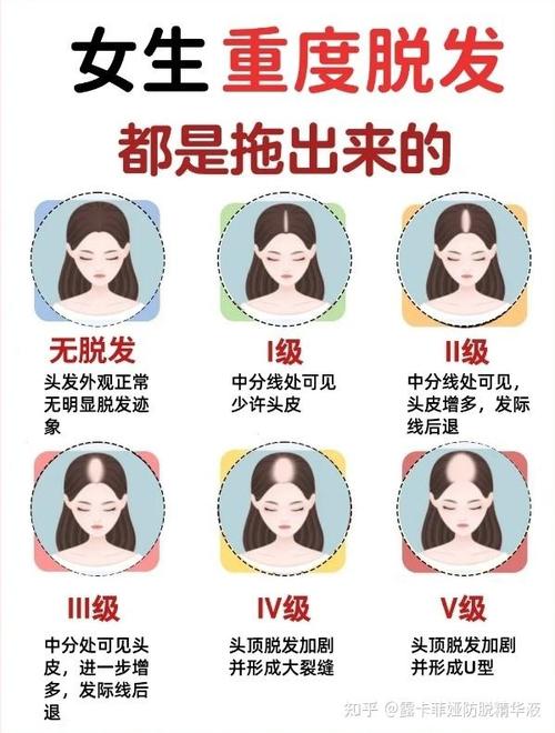 斑秃最好的恢复方法