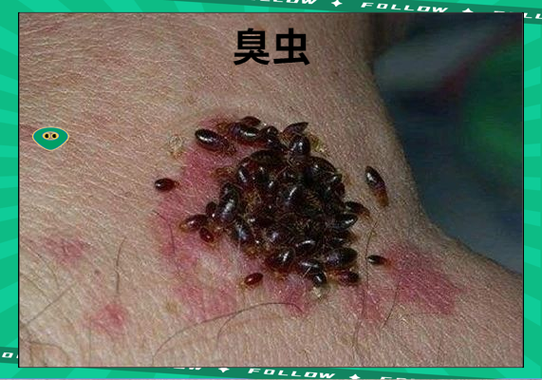 臭虫最怕的三种东西图标