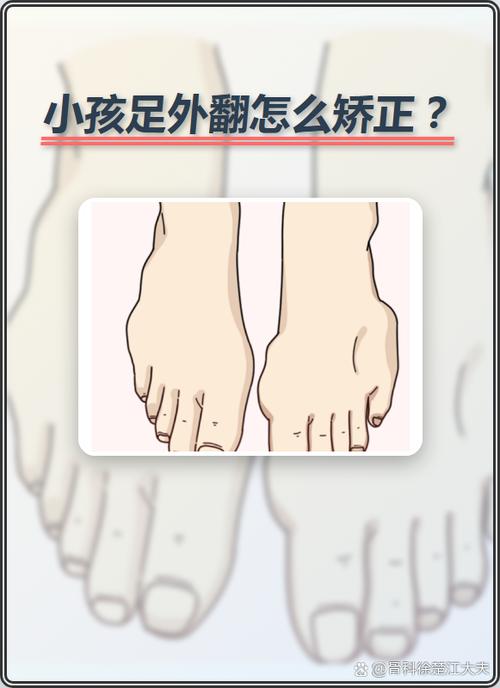 鞋底往外侧倾斜怎么办图标