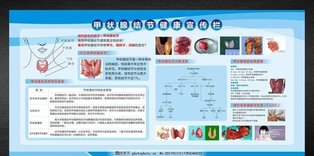 甲状腺峡部结节危险吗