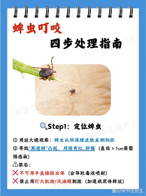 被蛐蛐咬了有没有事图标