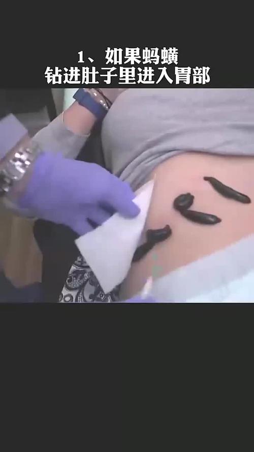 毒虫钻入女生的肚脐里
