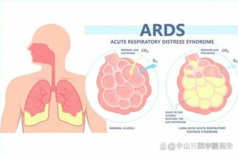 综合症是一种什么病图标
