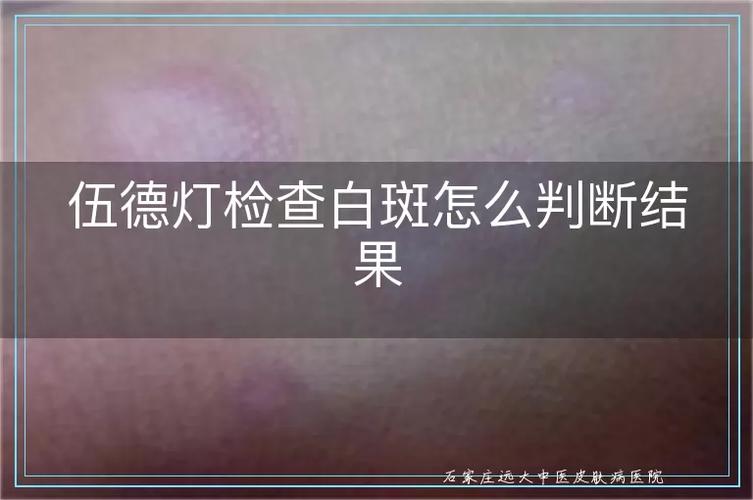 手机屏幕出现白斑是什么问题导致的