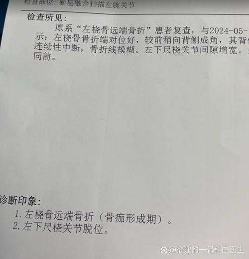 电信固定时间掉线是什么原因