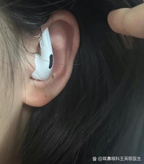 耳朵戴不住耳机怎么办游戏截图