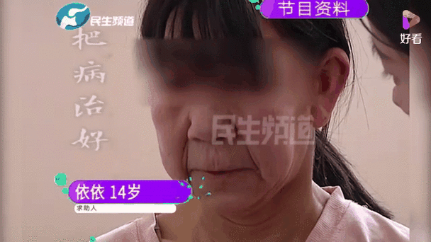 14岁女孩长得跟老人一样图标