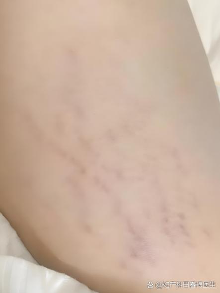 妈妈纹怎么去除图标