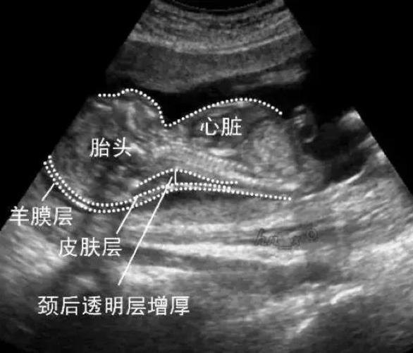 测孕棒怎么显示一深一浅是怀孕了图标