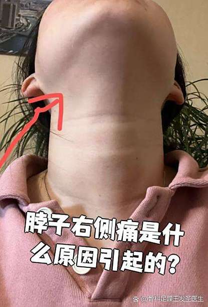 右边的脖子疼是怎么回事缩略图
