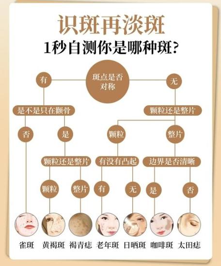 雀斑怎么去除缩略图