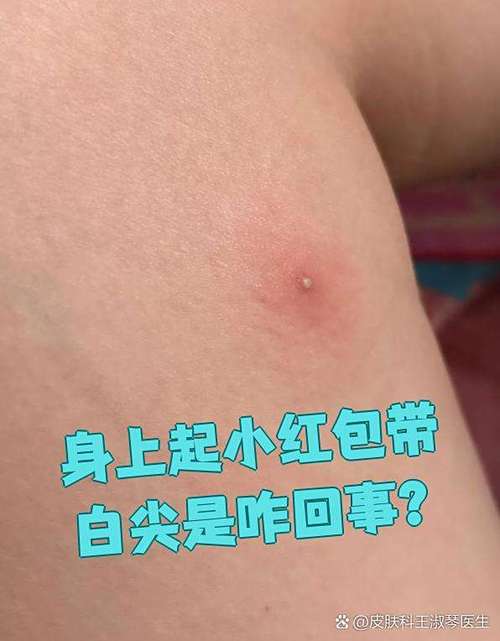 胸口小红包越来越多游戏截图