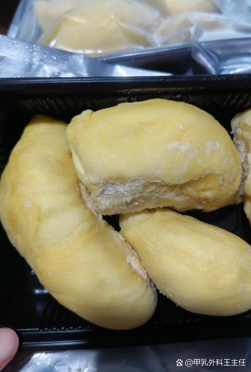 有结节可以吃榴莲吗