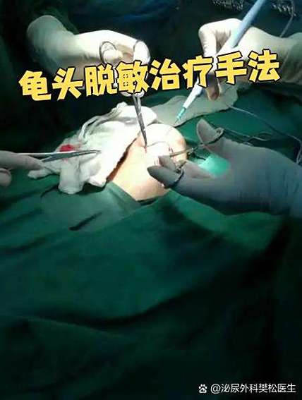 龟脱敏针一旦用了就不能停吗