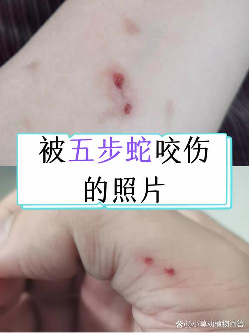 51昆咬短视频缩略图