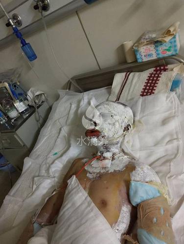 平板爆炸能炸死人吗图标