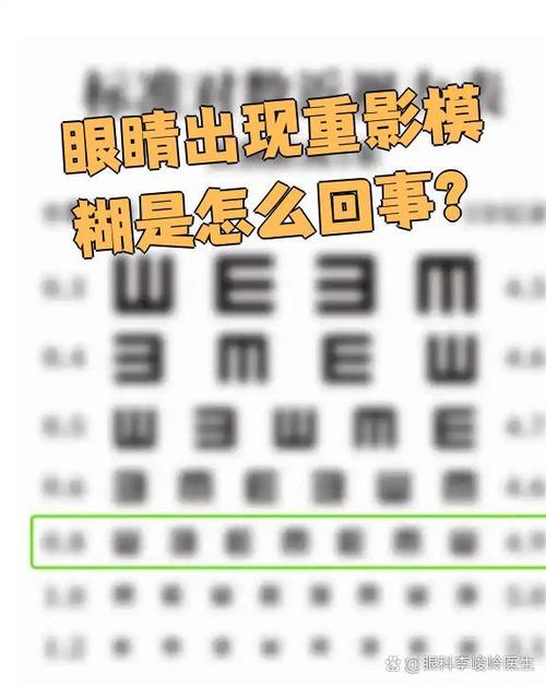 眼睛视力模糊什么原因造成的缩略图