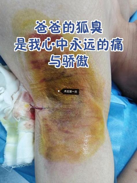 有狐臭可以当警察吗缩略图