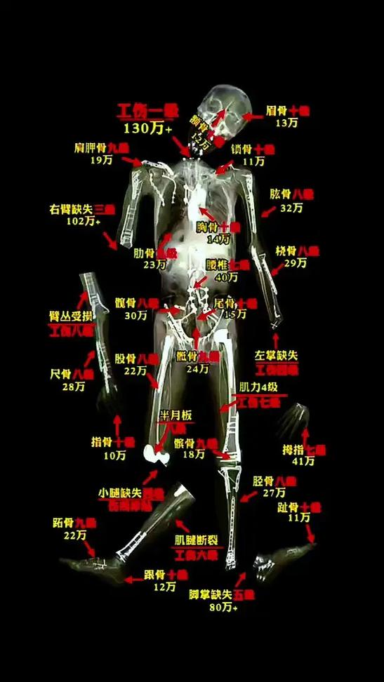 轻微骨折对方全责赔偿多少图标