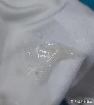 咳嗽出一坨一坨的灰色痰缩略图