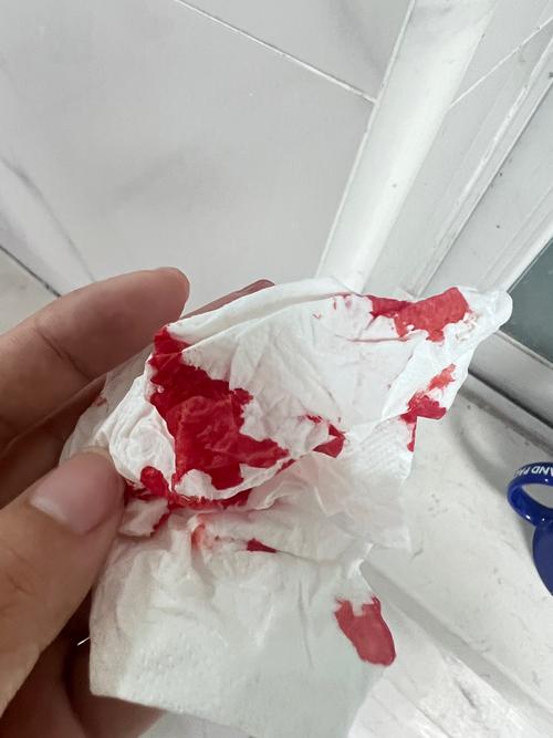 熬夜熬到流鼻血图标