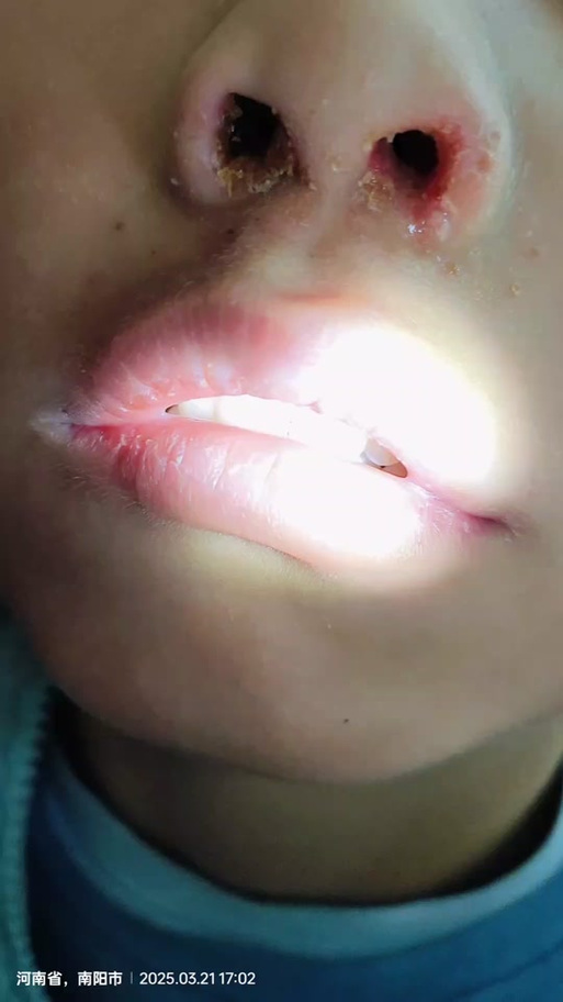 抠鼻孔变大的图片