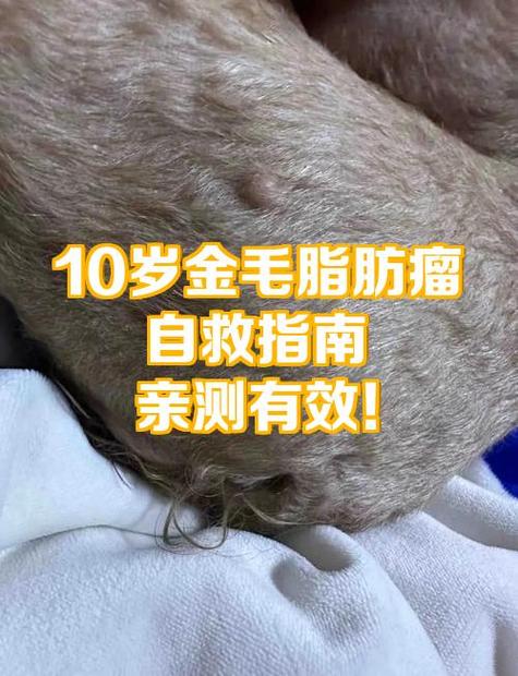 脂肪瘤的治疗方法