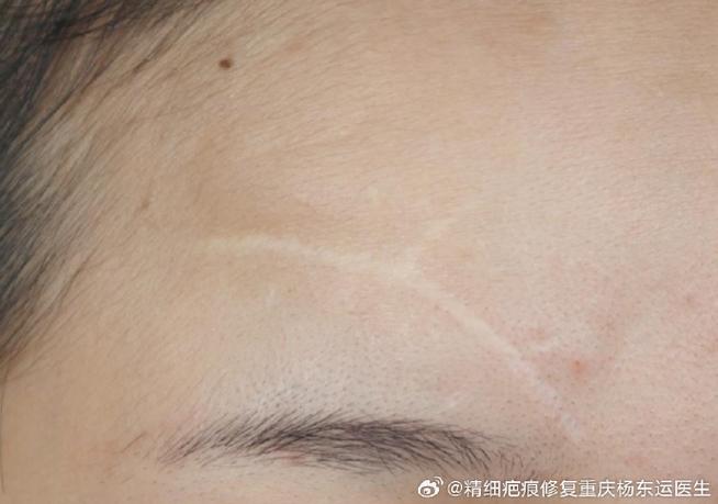 手机屏幕中间出现一条白色竖线