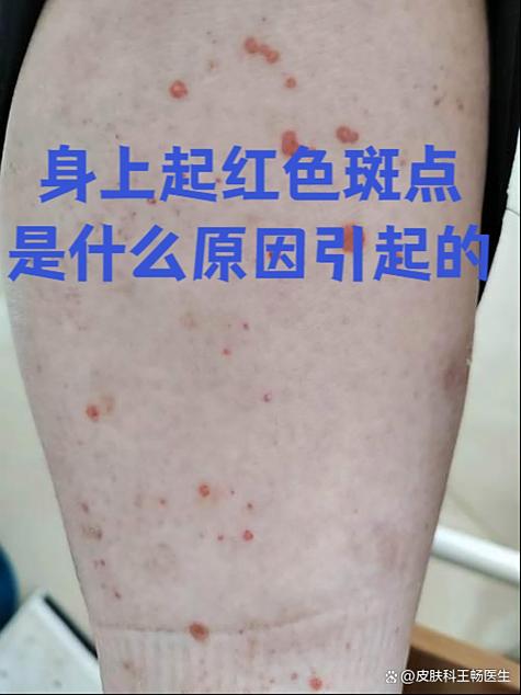 手脚起小红点很痒越挠越痒