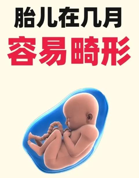 胎儿为什么会畸形