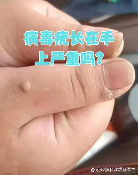什么是病毒油
